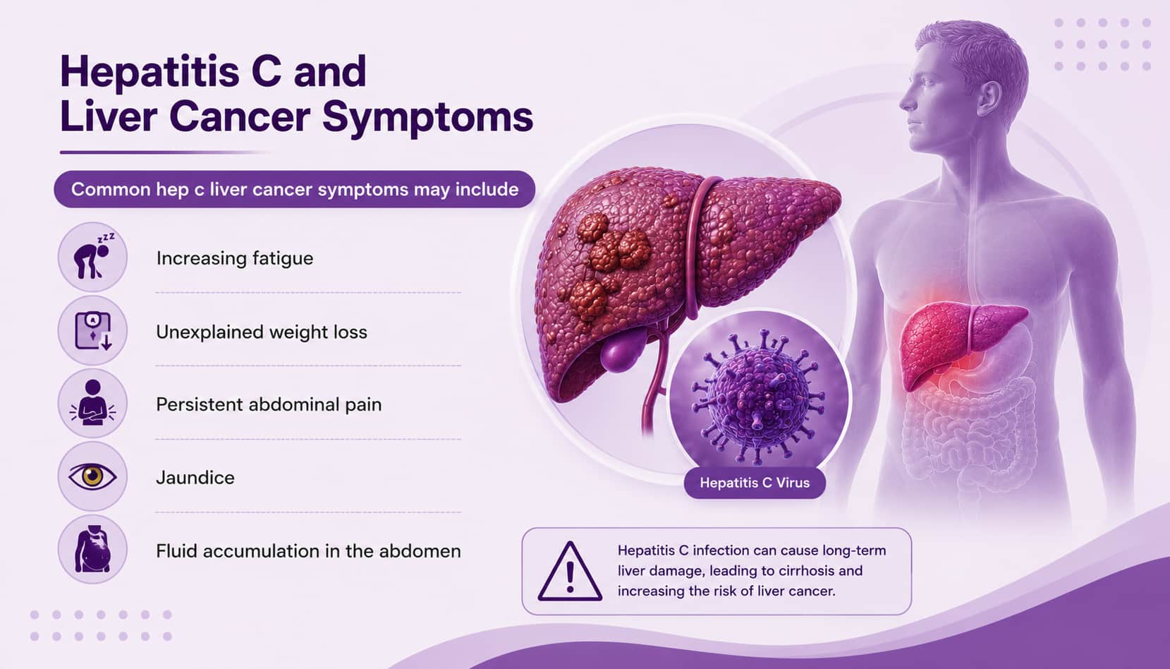 Hepatitis C and Liver Cancer Symptoms