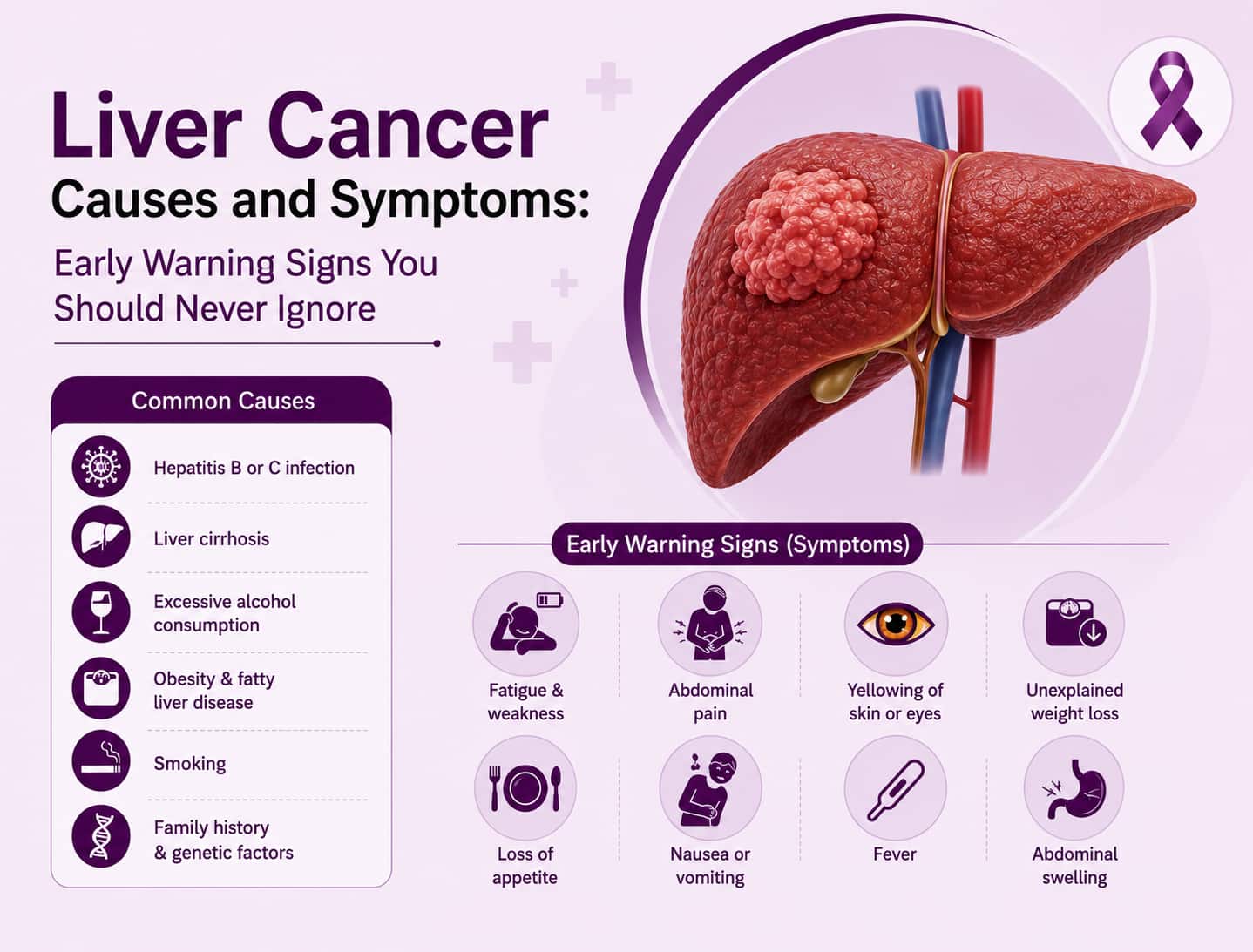 Liver cancer 