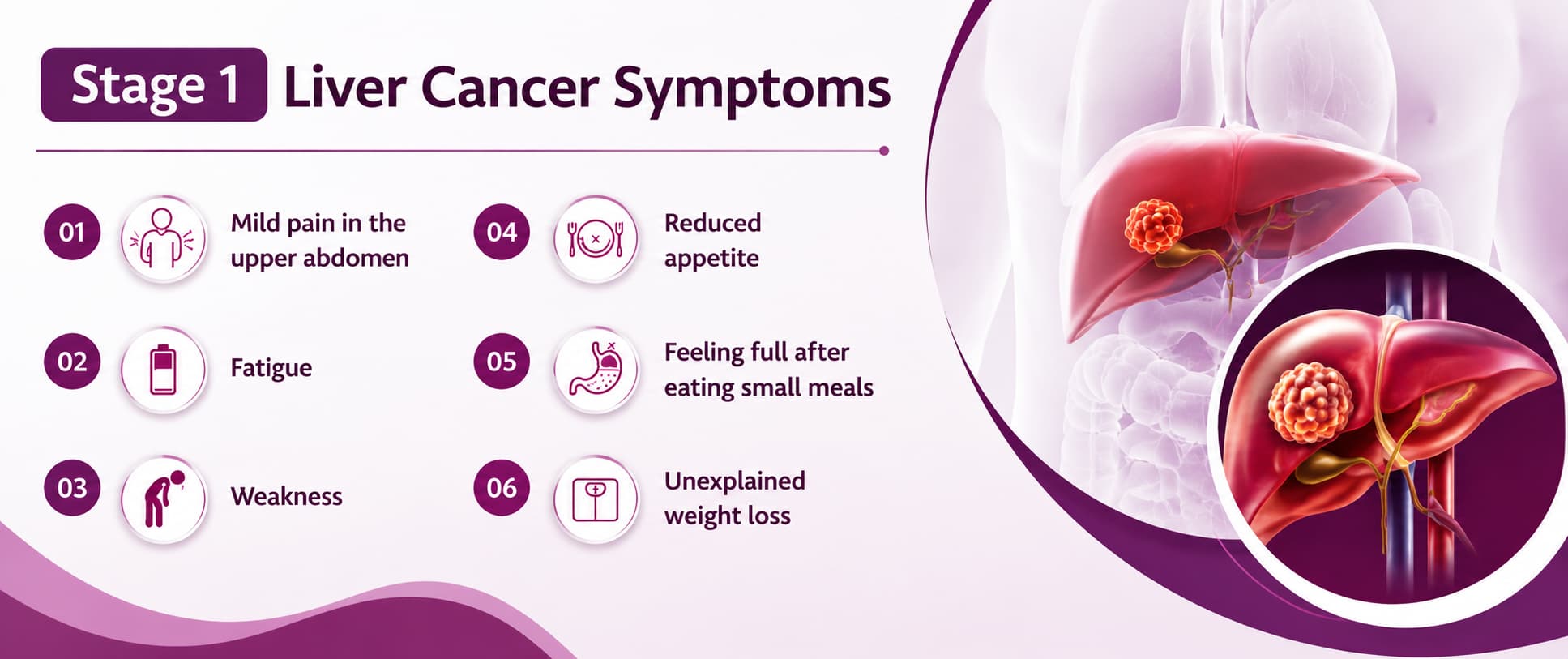 Symptoms of Liver Cancer Stage 1