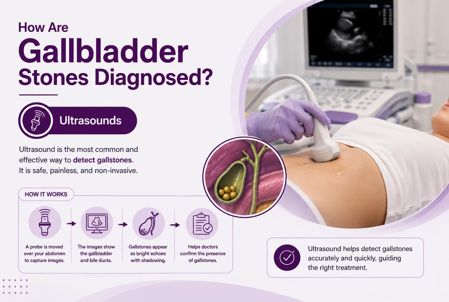 How Are Gallbladder Stones Diagnosed Ultrasounds