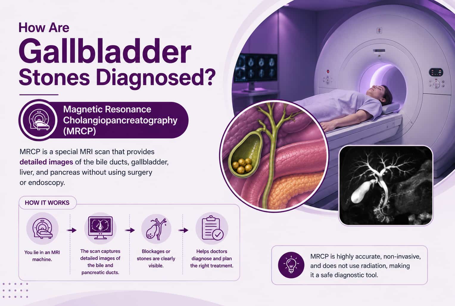 Magnetic Resonance Cholangiopancreatography (MRCP)
