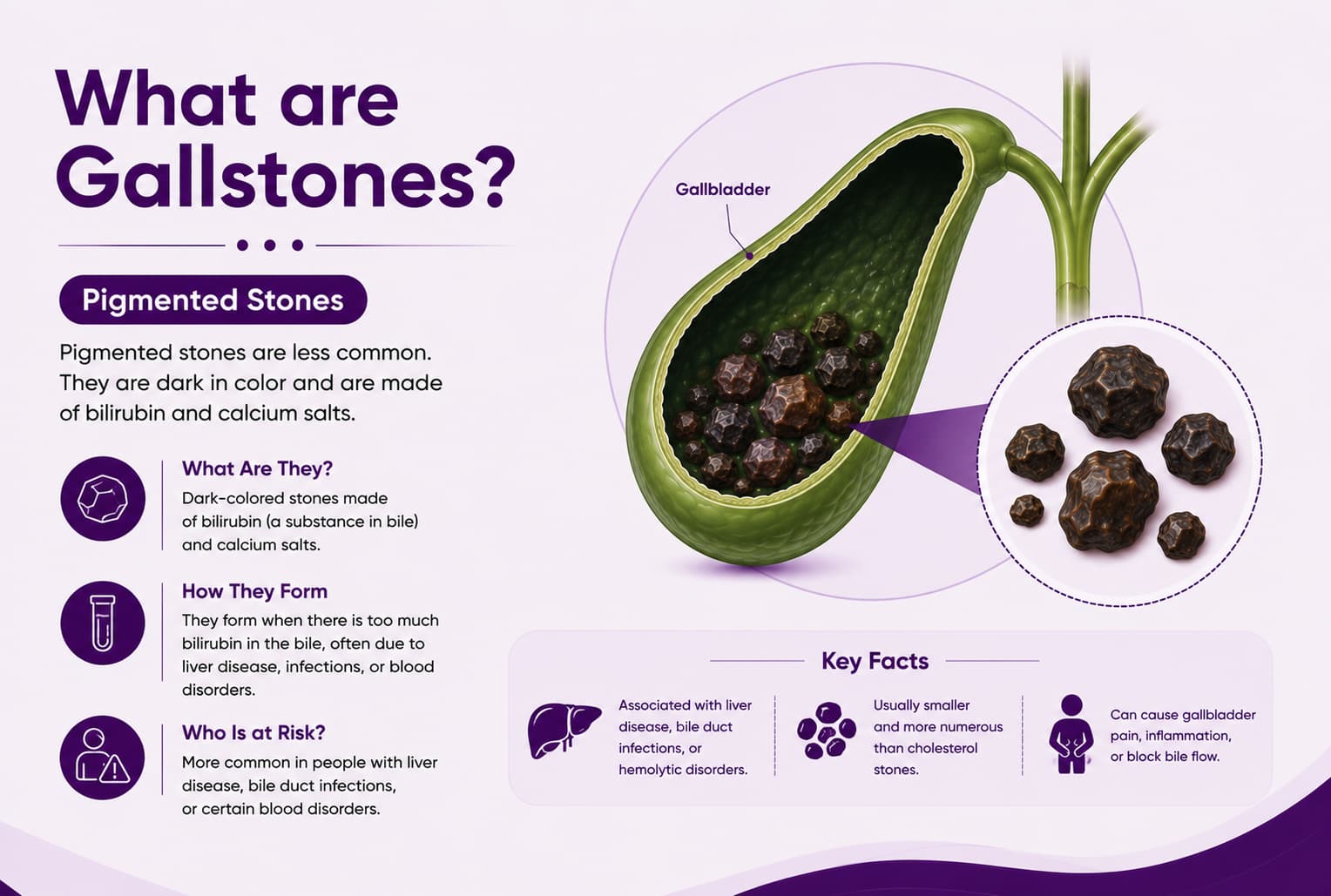 Pigmented stones