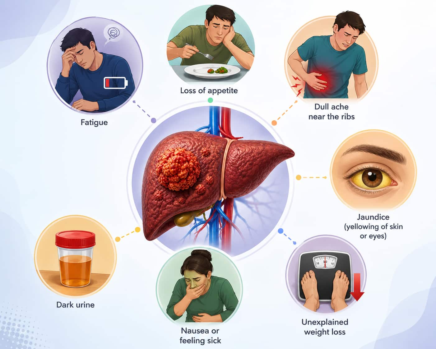 Early signs of liver cancer