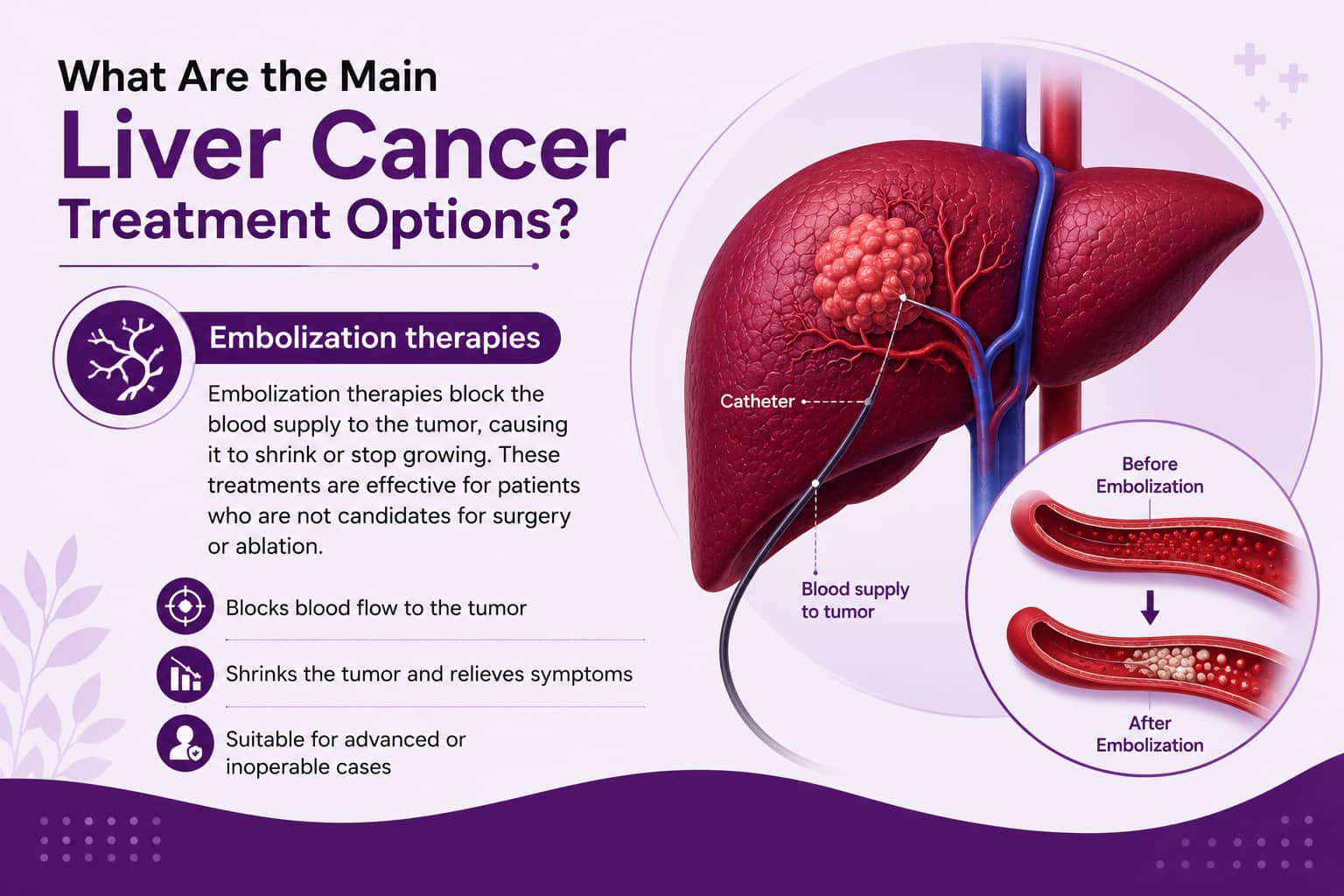 Embolization therapies
