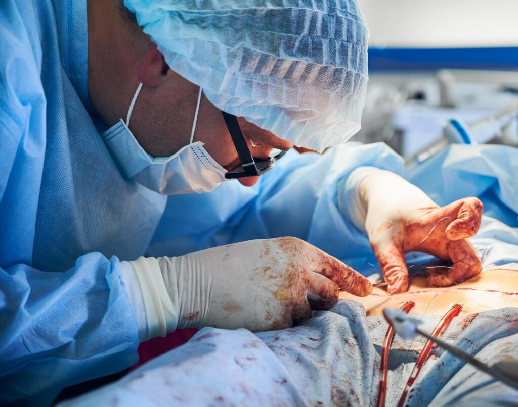 Liver Cancer surgery